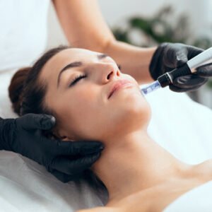 Micro-Needle Therapy – Scar reduction & skin renewal