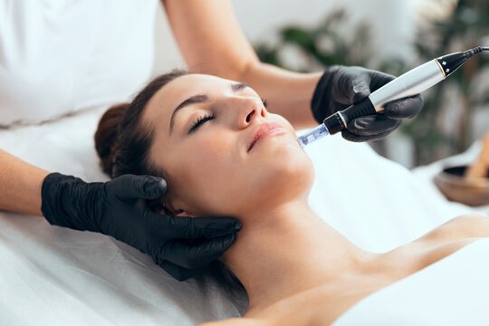 Micro-Needle Therapy – Scar reduction & skin renewal