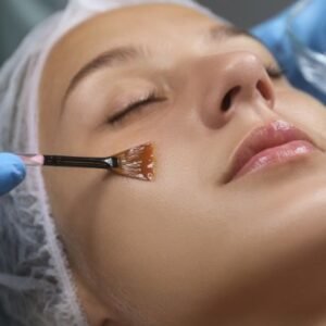 • Glycolic Peel – Skin resurfacing & even tone
