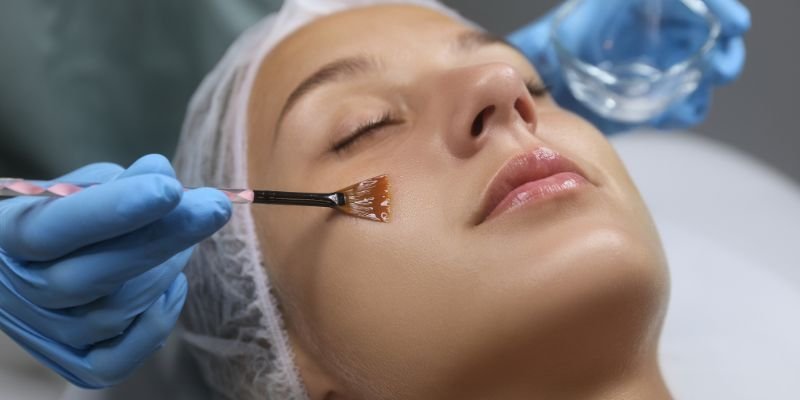 • Glycolic Peel – Skin resurfacing & even tone