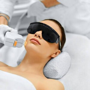 Full Face Laser – Smooth & clear facial skin